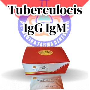 RAPID TEST TUBERCULOSIS IGG IGM GLORY
