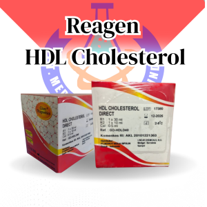 HDL-CHOLESTEROL Direct w/o cal