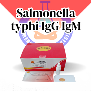 RAPID TEST SALMONELA TYPHI (TYPHOID) GLORY