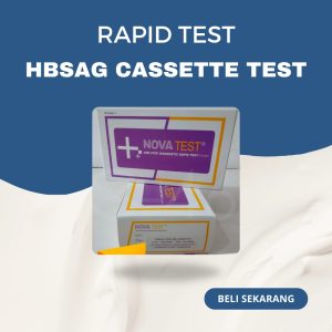 HBsAg SERUM TEST NOVA