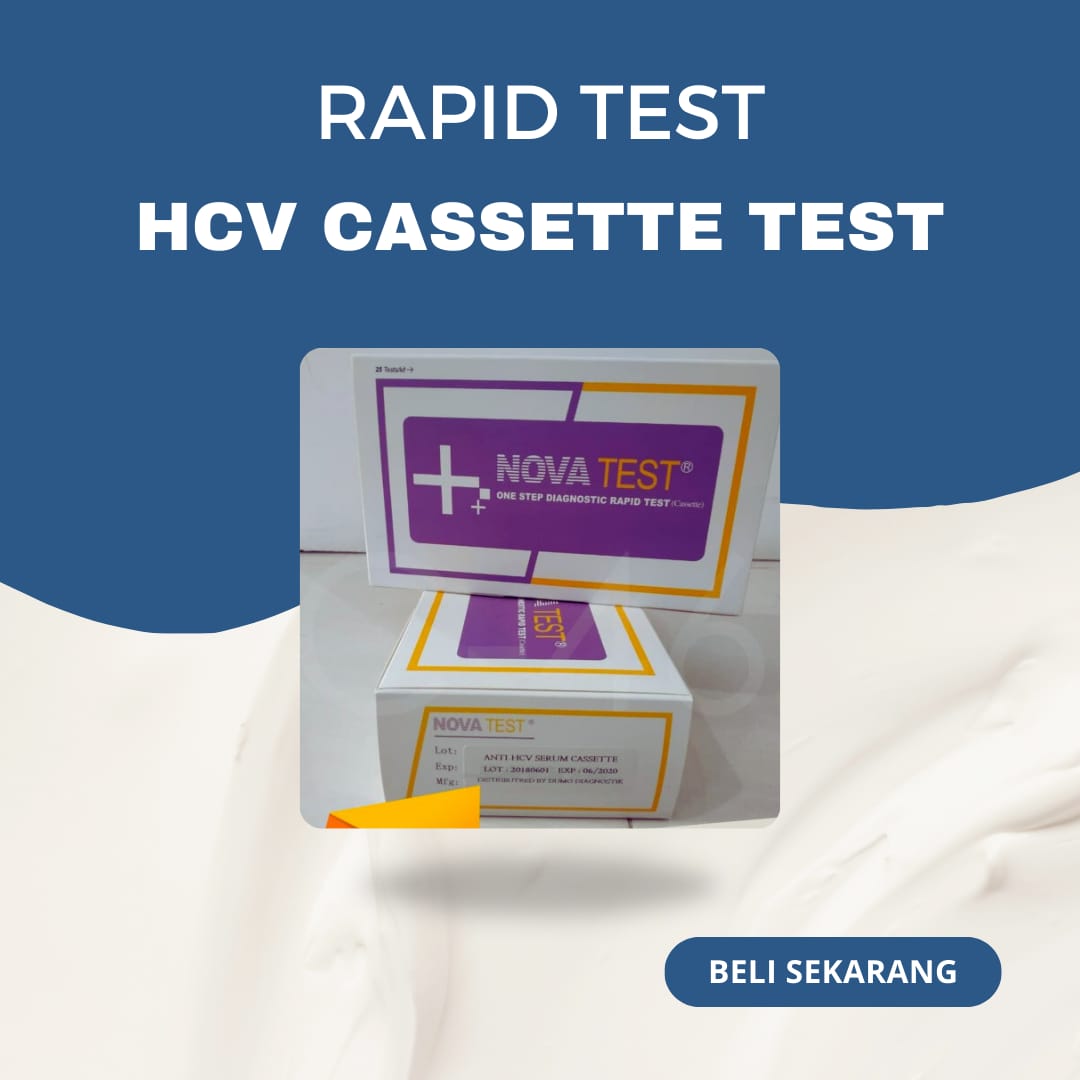 HBsAb SERUM TEST NOVA