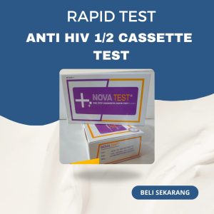 ANTI-HIV 1/2 TYPES TEST NOVA