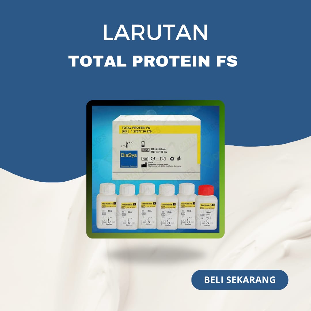 REAGEN TOTAL PROTEIN FS DIASYS